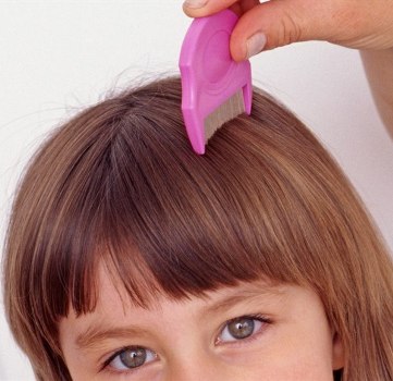 Ilustrační obrázek článku - Nezvaní návštěvníci ve II.B - VŠI